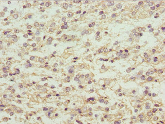 Maged1 Polyclonal Antibody - image 3