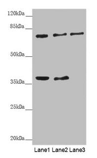 Immunohistochemistry of paraffin-embedded human brain tissue using CAC10792 at dilution of 1:100