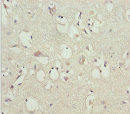 Immunohistochemistry of paraffin-embedded human adrenal gland tissue using CAC10792 at dilution of 1:100
