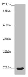 Immunohistochemistry of paraffin-embedded human kidney tissue using CAC10798 at dilution of 1:100