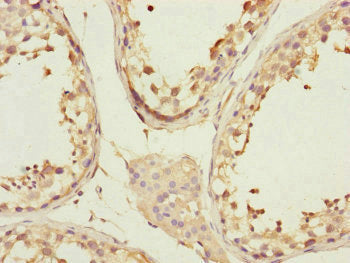 Cchcr1 Polyclonal Antibody - image 3