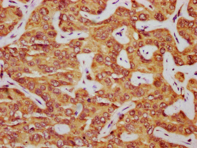 Immunofluorescence staining of HepG2 cells with CAC10817 at 1:108, counter-stained with DAPI. The cells were fixed in 4% formaldehyde, permeabilized using 0.2% Triton X-100 and blocked in 10% normal Goat Serum. The cells were then incubated with the antibody overnight at 4°C. The secondary antibody was Alexa Fluor 488-congugated AffiniPure Goat Anti-Rabbit IgG(H+L).