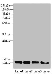 Immunohistochemistry of paraffin-embedded human brain tissue using CAC10822 at dilution of 1:100