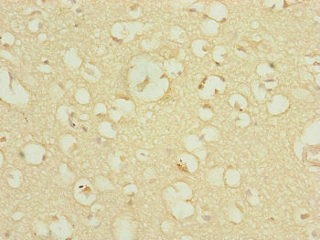 Immunohistochemistry of paraffin-embedded human kidney tissue using CAC10822 at dilution of 1:100