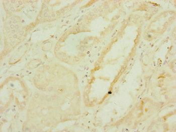 Immunoprecipitating DNAJC19 in Hela whole cell lysate; , Lane 1: Rabbit control IgG instead in Hela whole cell lysate. For western blotting, a HRP-conjugated Protein G antibody was used as the secondary antibody (1/2000); , Lane 2: CAC10822 (8µg) + Hela whole cell lysate (500µg); , Lane 3: Hela whole cell lysate (10µg)