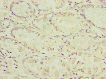 Rars2 Polyclonal Antibody - image 4