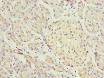 Immunofluorescent analysis of MCF-7 cells using CAC10833 at dilution of 1:100 and Alexa Fluor 488-congugated AffiniPure Goat Anti-Rabbit IgG(H+L)