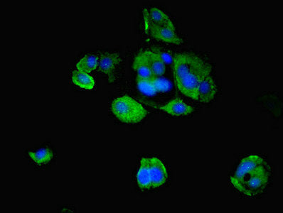 Mid2 Polyclonal Antibody - image 5