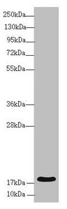 Immunohistochemistry of paraffin-embedded human liver cancer using CAC10837 at dilution of 1:100