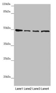 Immunohistochemistry of paraffin-embedded human placenta tissue using CAC10840 at dilution of 1:100