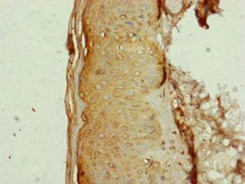 Ap1M1 Polyclonal Antibody - image 4