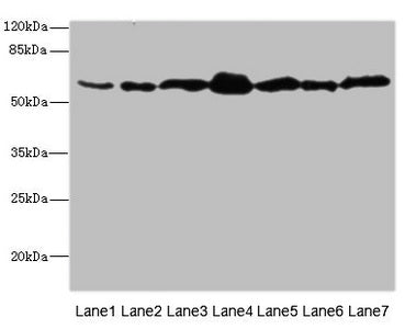Immunohistochemistry of paraffin-embedded human kidney tissue using CAC10853 at dilution of 1:100