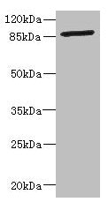 Immunohistochemistry of paraffin-embedded human colon cancer using CAC10855 at dilution of 1:100