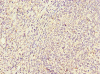 Immunohistochemistry of paraffin-embedded human spleen tissue using CAC10856 at dilution of 1:100
