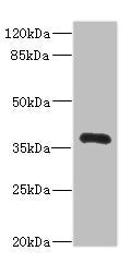 Immunohistochemistry of paraffin-embedded human testis tissue using CAC10861 at dilution of 1:100