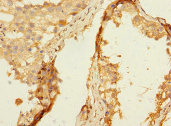 Immunohistochemistry of paraffin-embedded human brain tissue using CAC10861 at dilution of 1:100