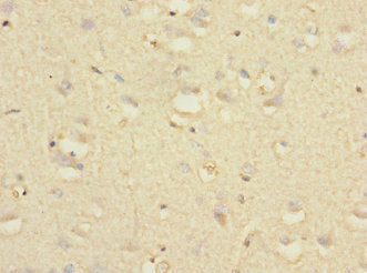 Ntm Polyclonal Antibody - image 4