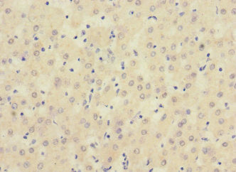 Immunohistochemistry of paraffin-embedded human adrenal gland tissue using CAC10868 at dilution of 1:100