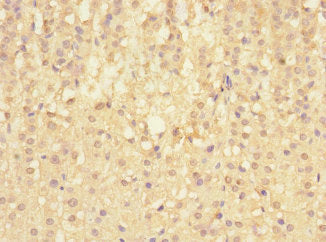 Sigirr Polyclonal Antibody - image 4