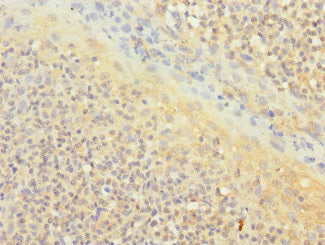 Immunohistochemistry of paraffin-embedded human spleen tissue using CAC10880 at dilution of 1:100