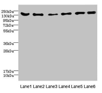 Immunohistochemistry of paraffin-embedded human liver tissue using CAC10881 at dilution of 1:100