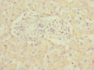 Adgrg6 Polyclonal Antibody - image 3