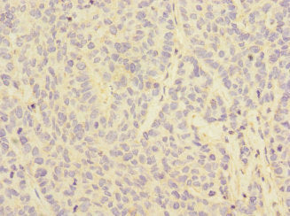 Immunohistochemistry of paraffin-embedded human kidney tissue using CAC10888 at dilution of 1:100