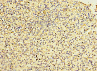 Stab2 Polyclonal Antibody - image 2