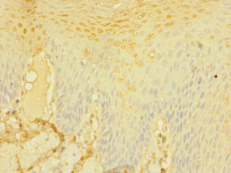 Immunohistochemistry of paraffin-embedded human brain tissue using CAC10905 at dilution of 1:100