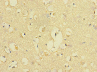 Cd226 Polyclonal Antibody - image 4
