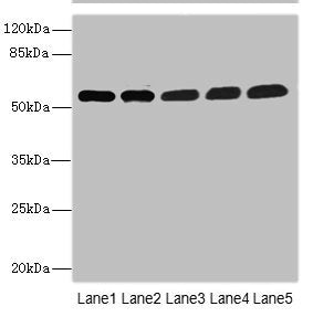 Immunohistochemistry of paraffin-embedded human testis tissue using CAC10908 at dilution of 1:100