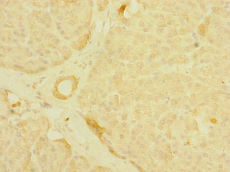 Mpp6 Polyclonal Antibody - image 4