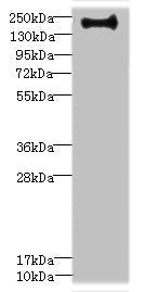 Immunohistochemistry of paraffin-embedded human melanoma using CAC10910 at dilution of 1:100