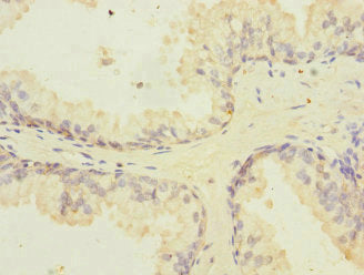 Ppil2 Polyclonal Antibody - image 3