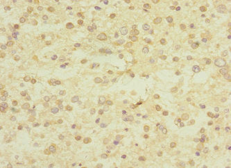 Immunohistochemistry of paraffin-embedded human kidney tissue using CAC10913 at dilution of 1:100