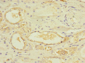Ube4A Polyclonal Antibody - image 4