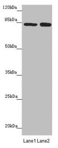 Immunohistochemistry of paraffin-embedded human liver tissue using CAC10918 at dilution of 1:100