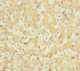 Immunohistochemistry of paraffin-embedded human kidney tissue using CAC10918 at dilution of 1:100