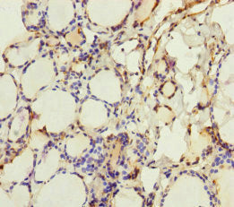 Immunohistochemistry of paraffin-embedded human heart tissue using CAC10921 at dilution of 1:100