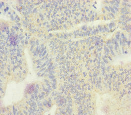 Echs1 Polyclonal Antibody - image 4