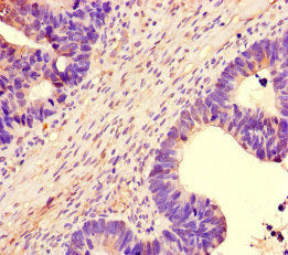 Immunofluorescent analysis of HepG2 cells using CAC10946 at dilution of 1:100 and Alexa Fluor 488-congugated AffiniPure Goat Anti-Rabbit IgG(H+L)