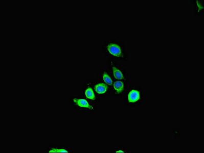 Sbf2 Polyclonal Antibody - image 4