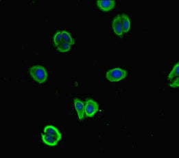 Nalcn Polyclonal Antibody - image 2