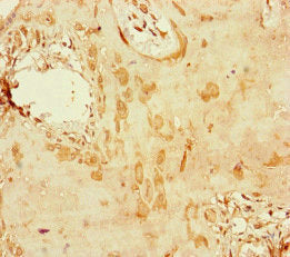 Immunofluorescent analysis of HepG2 cells using CAC10955 at dilution of 1:100 and Alexa Fluor 488-congugated AffiniPure Goat Anti-Rabbit IgG(H+L)