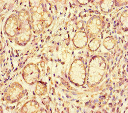 Immunohistochemistry of paraffin-embedded human testis tissue using CAC10959 at dilution of 1:100