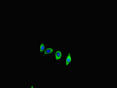 Ace2 Polyclonal Antibody - image 4