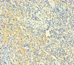 Immunohistochemistry of paraffin-embedded human spleen tissue using CAC10962 at dilution of 1:100