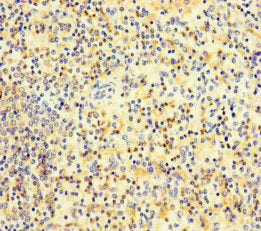 Immunofluorescent analysis of HepG2 cells using CAC10962 at dilution of 1:100 and Alexa Fluor 488-congugated AffiniPure Goat Anti-Rabbit IgG(H+L)