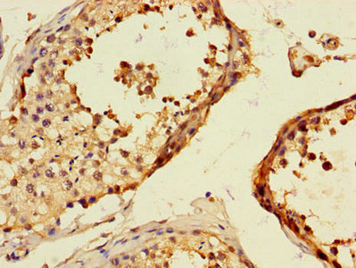 Immunofluorescent analysis of Hela cells using CAC10966 at dilution of 1:100 and Alexa Fluor 488-congugated AffiniPure Goat Anti-Rabbit IgG(H+L)