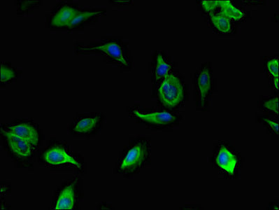 Tll1 Polyclonal Antibody - image 4